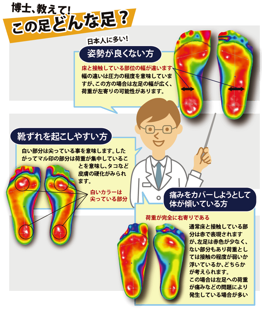 よくある足の異常